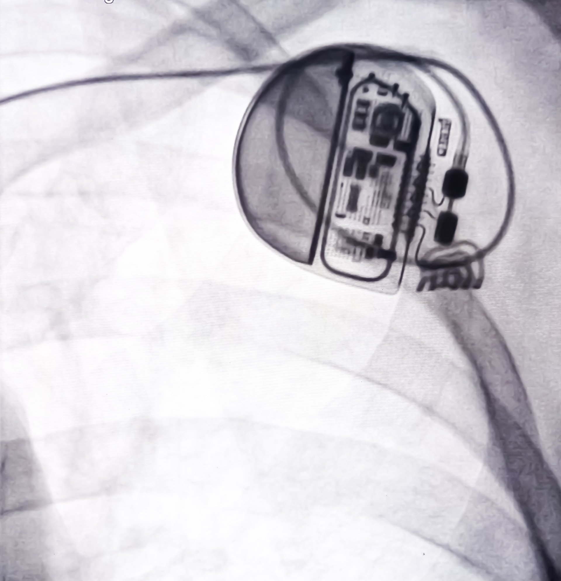 Laboratorio de cateterismo cardíaco